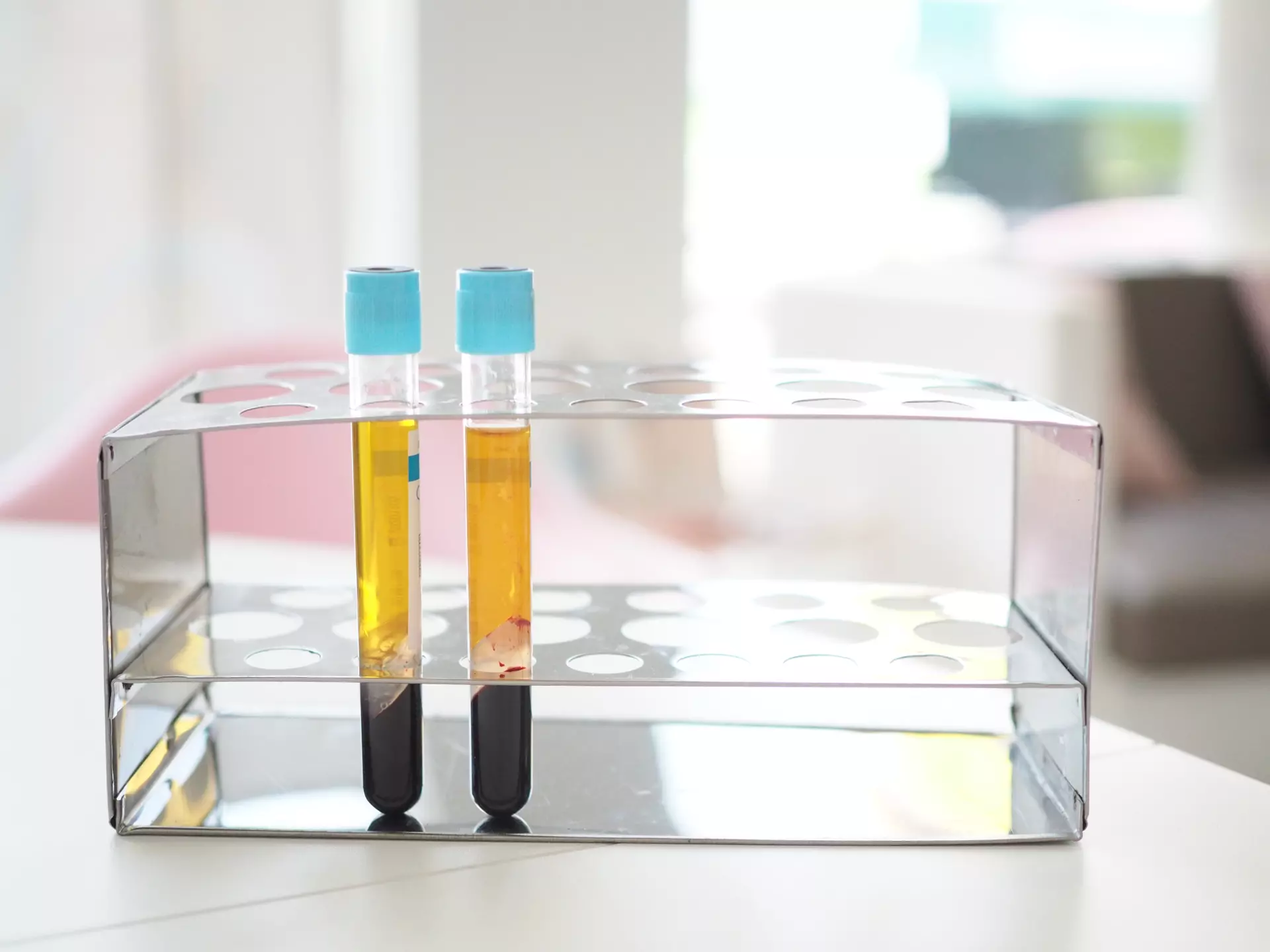 Platelet Rich Plasma (PRP) Injections